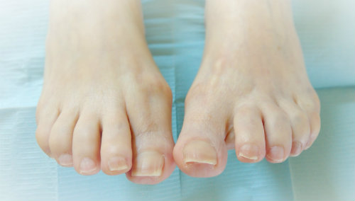 Après un soin de santé pour vos pieds, la cuticule n'est jamais repoussée ou taillée...elle est intégralement préservée et conserve son rôle d'étanchéité à 100%...!